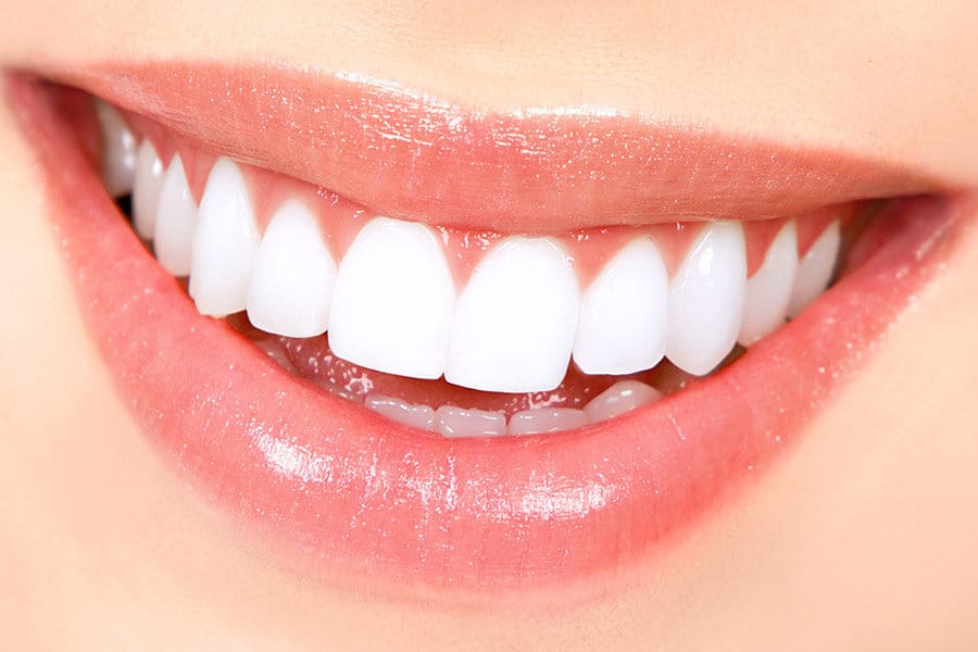 Pearly White Teeth