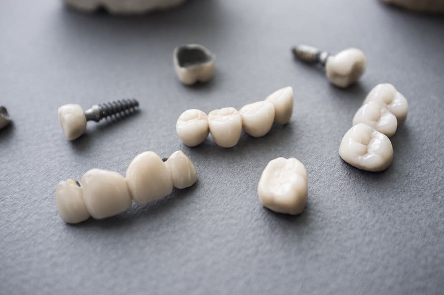 Dentures and Over-dentures