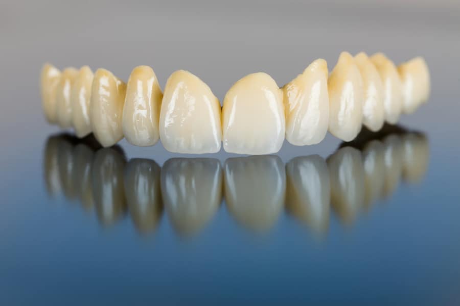 Alternative Techniques for Dental Implants