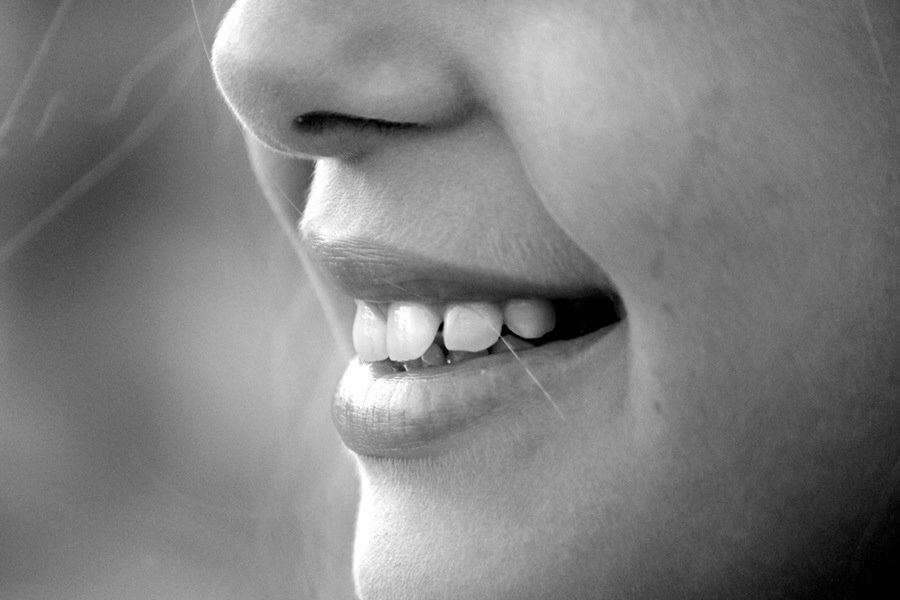 FAQs About Dental Veneers - Featured Image