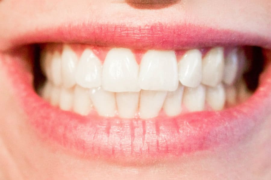 Cosmetic dentistry photo