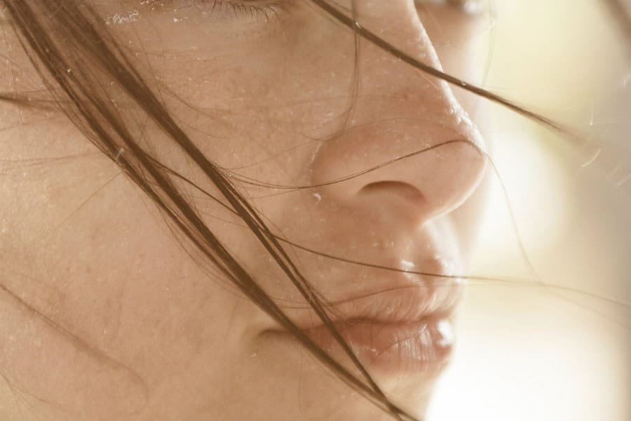 lip fillers