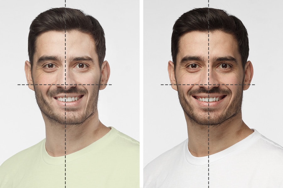 How To Fix an Asymmetrical Face - Featured Image