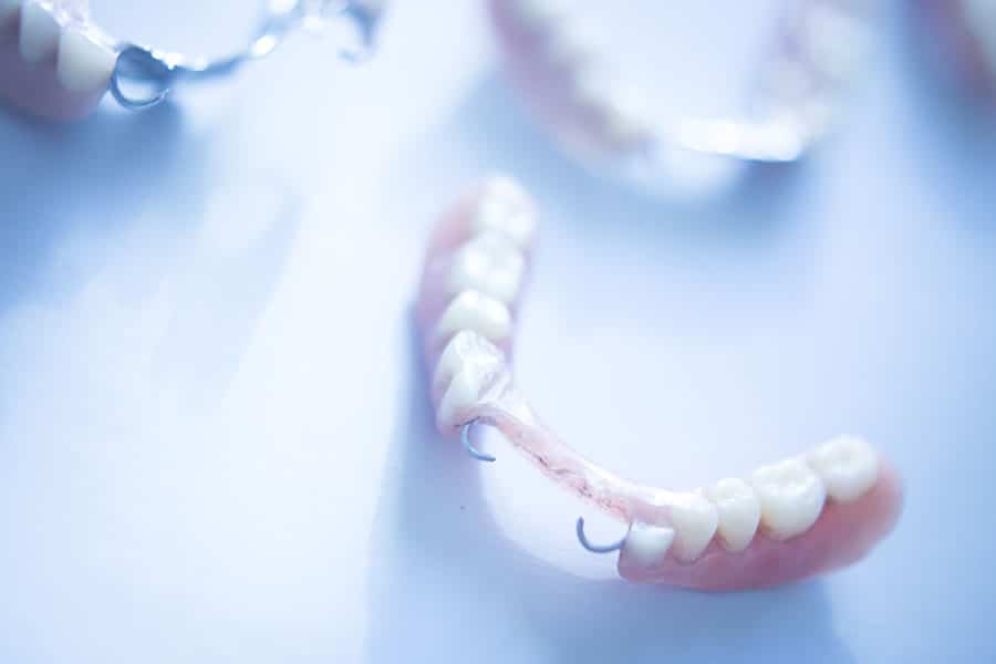 Types of Partial Dentures