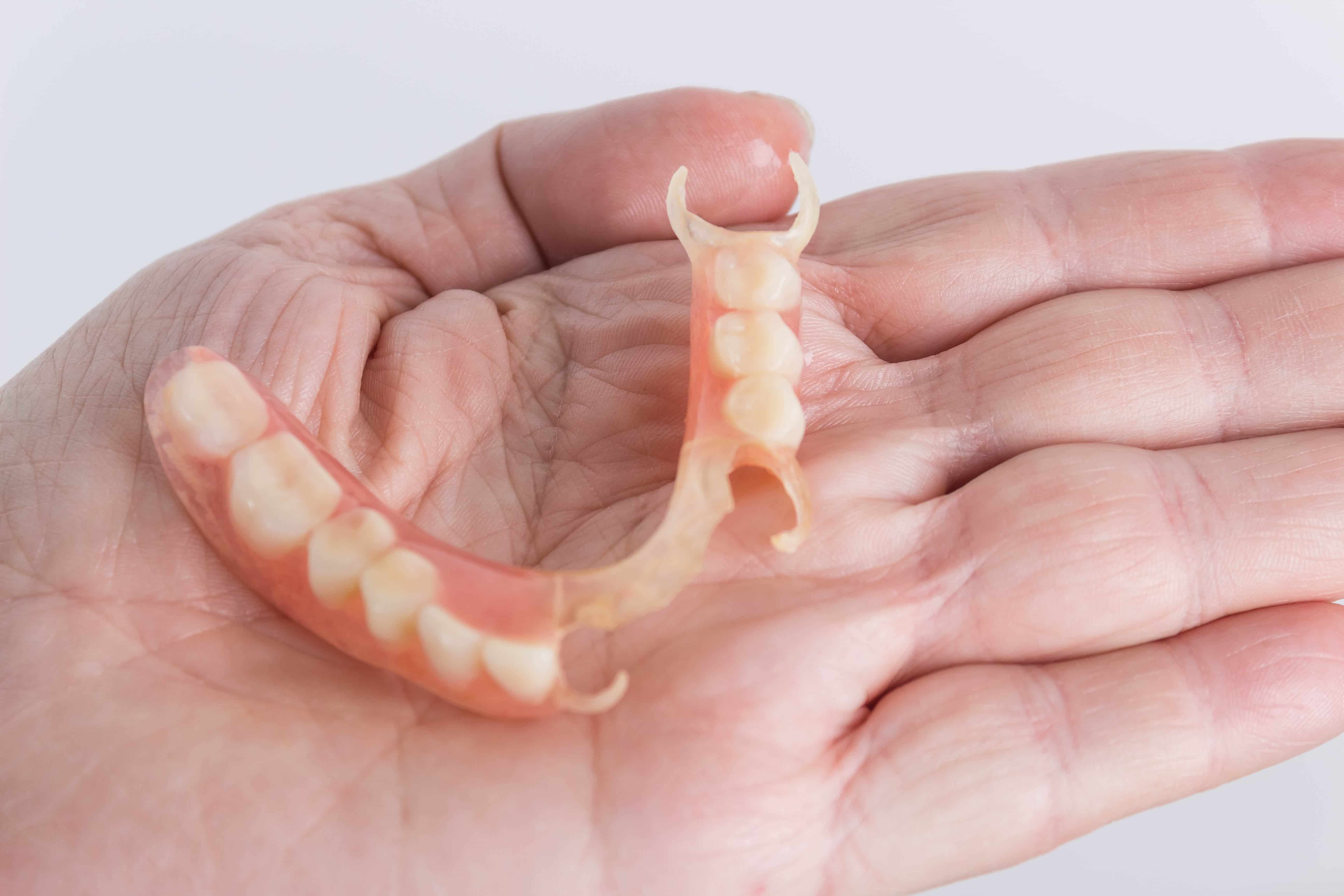 Why you should choose flexible partial dentures over traditional ones - Featured Image