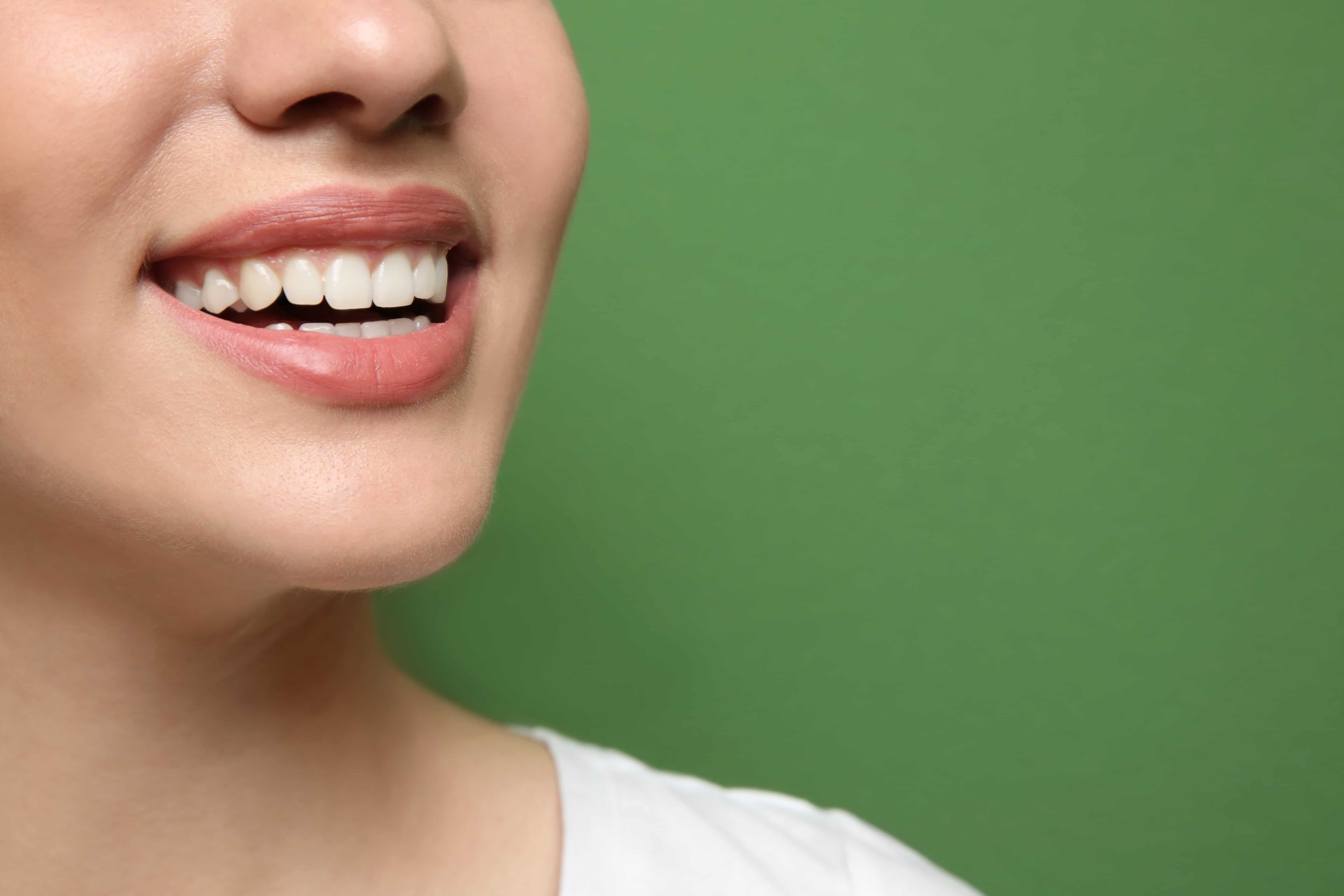 How Dental Bonding Can Erase Your Tooth Gaps - Featured Image