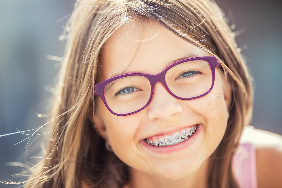 Best Age For Braces
