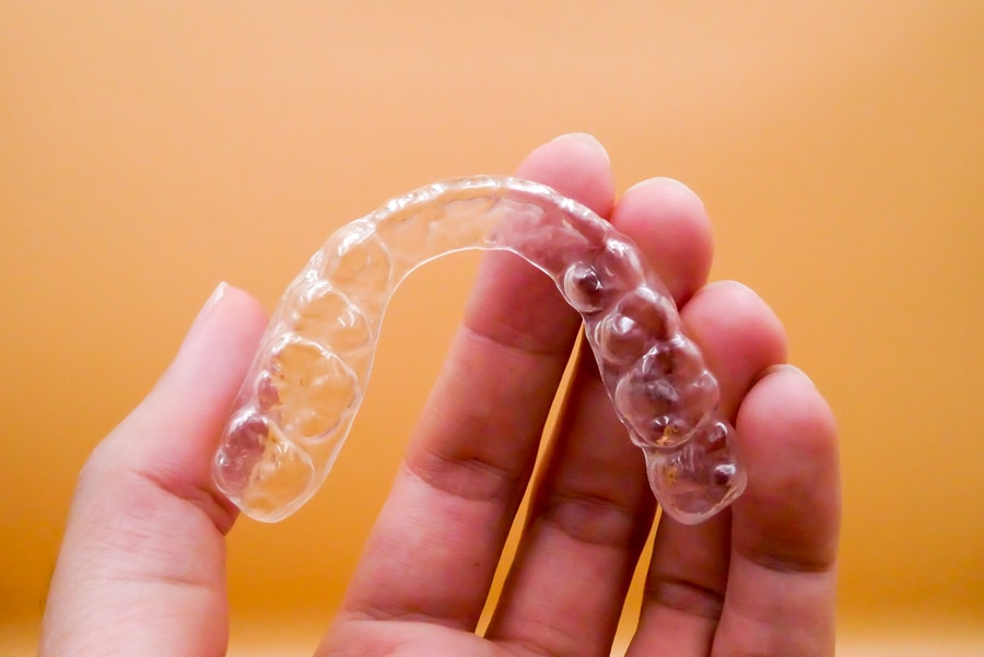 How Long Does Invisalign Take? - Featured Image