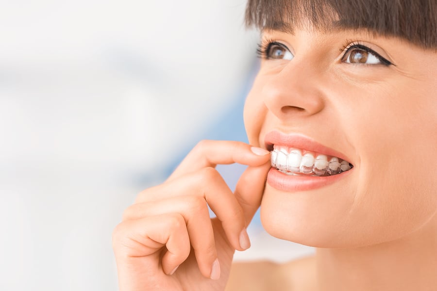 Invisalign Cost, Benefits, and Convenience - Featured Image