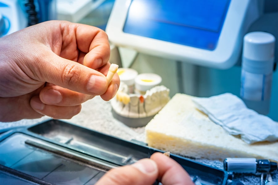 Veneers Cost