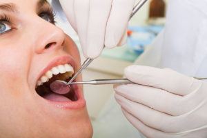 denture vs implants