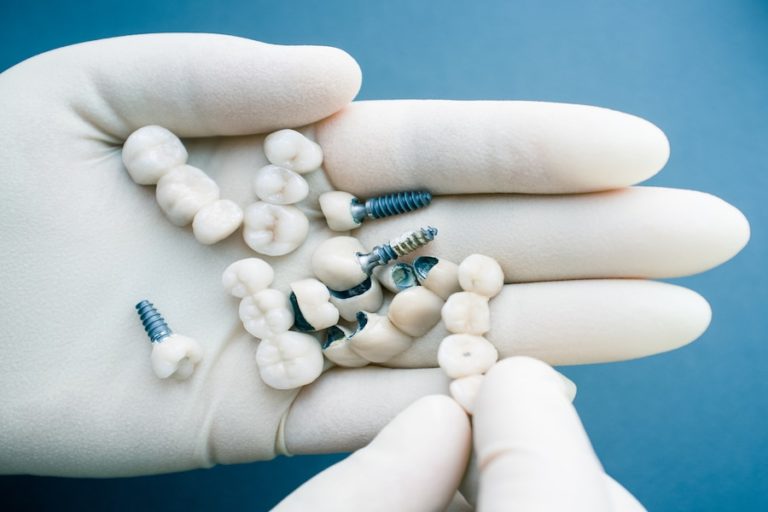 Dental Implant Procedure Timeline EVDP