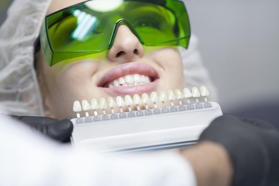 Top 6 Most Effective Teeth Whitening Methods - Featured Image