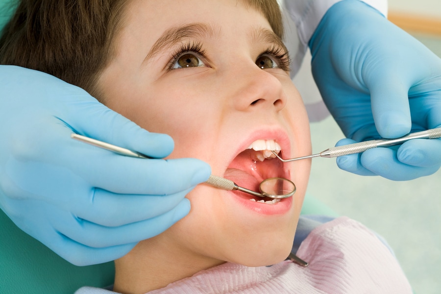 How to treat Cavities in Baby Teeth - Featured Image