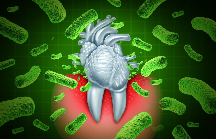 Gum Health and Heart Health: The Link Between Gum Disease and Heart Attack - Featured Image