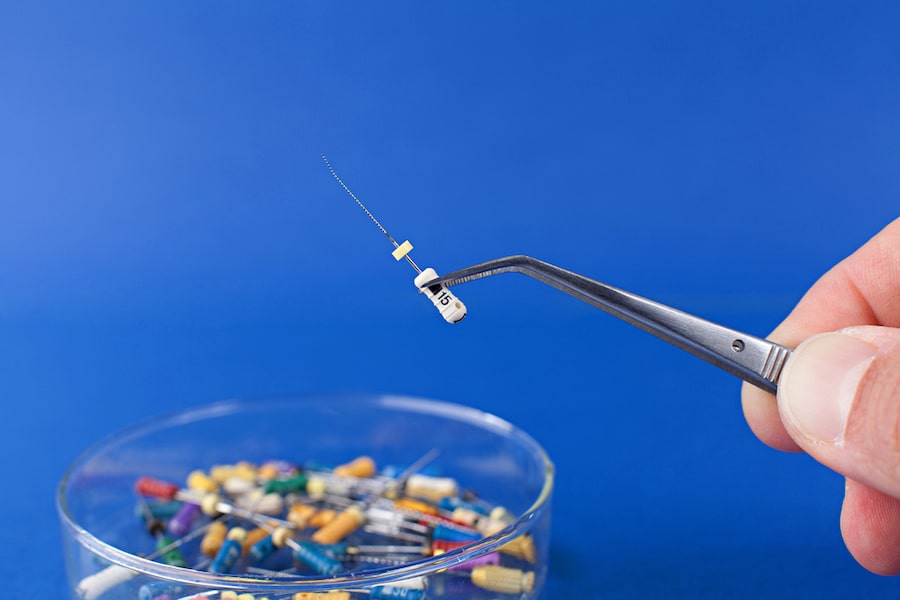 Root Canal Process