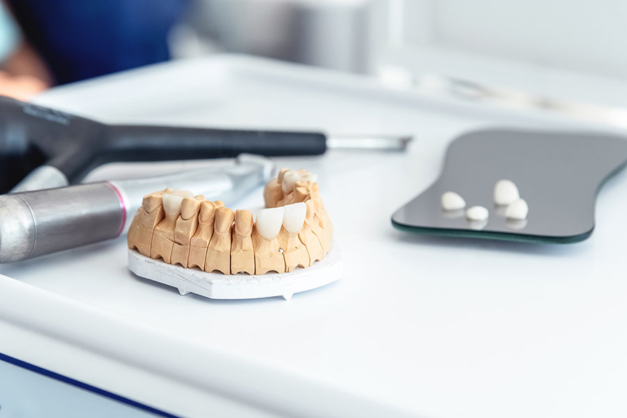 ceramic vs porcelain crowns