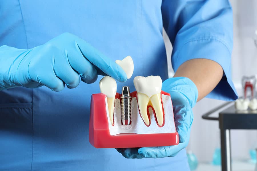 what dental insurance covers crowns