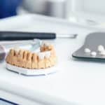 how common are dental crowns