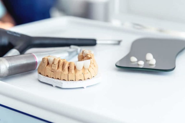 How Common Are Dental Crowns EVDP