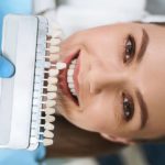 pop on veneers