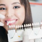 color options for dental crowns