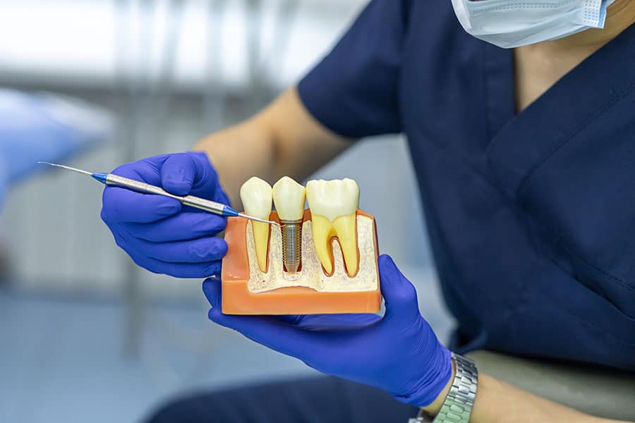 dental implants vs crowns