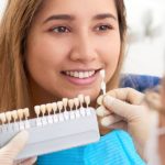 are veneers covered by insurance