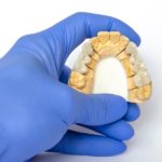 what are dental bridges