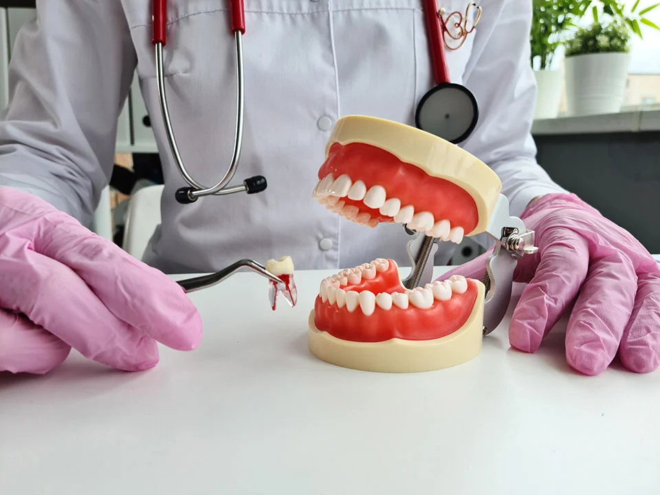 Tooth Extractions - Image