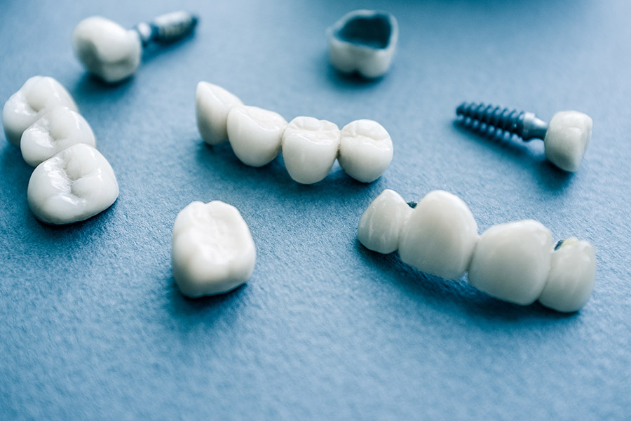 Dental Implants vs. Dentures (and Bridges): Mesa Dentist Explains Your Best Option - Featured Image