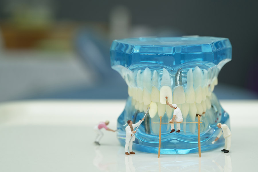 Caring for Your Dental Implants: A Guide for Dobson Ranch Residents - Featured Image
