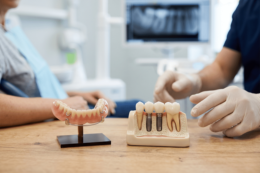 partial dentures vs implants Mesa