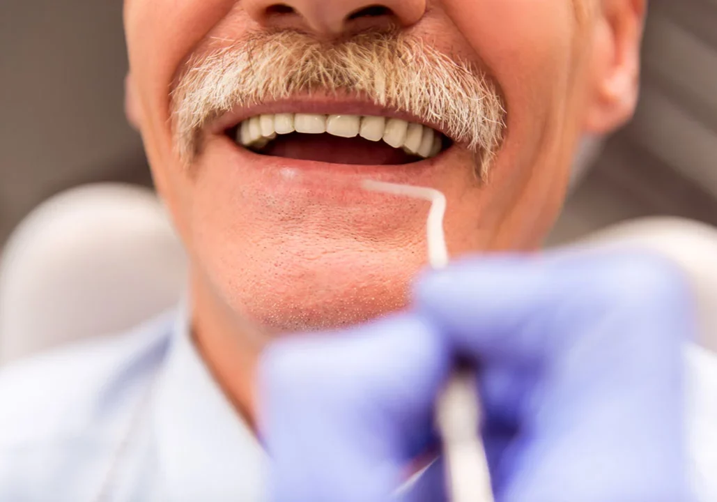 dental bonding