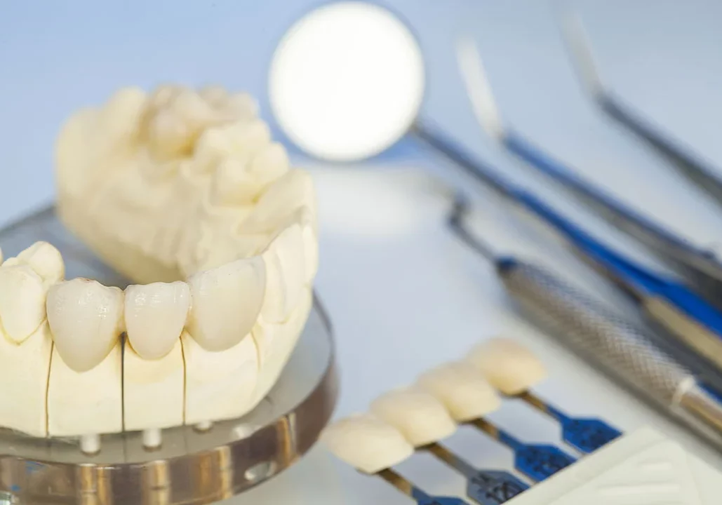 dental Crowns