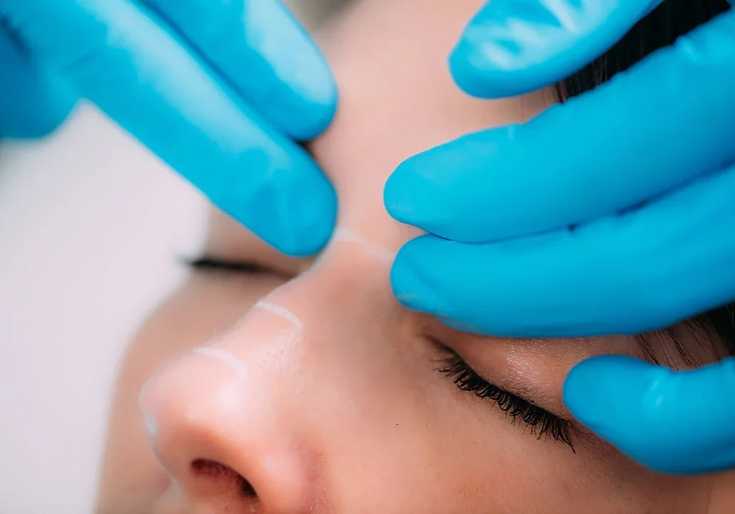 Dermal Fillers in Mesa