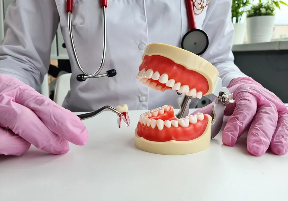 Tooth Extractions