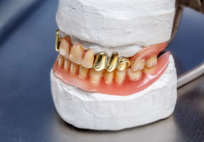 types of dental crowns