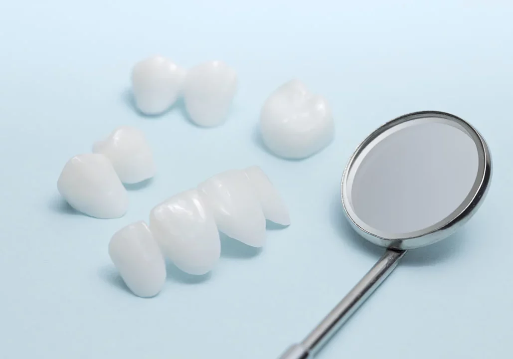 dental Lumineers
