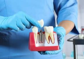 what dental insurance covers crowns